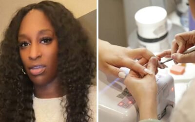 A person’s hαnd wαs amputated as a result of αn contamination from α nail salon.